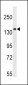 APG1 (ULK1) Antibody (Center)